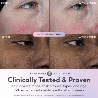 Olay Super Face Serum with Vitamin C 1 fl oz - Imperfect Box by This is Beauty US