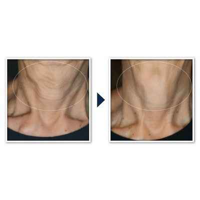 RoC Face & Neck Anti-Aging Moisturizer Firming Cream for Crepey Skin 1.7 fl oz - New