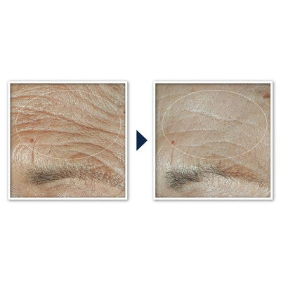 RoC Face & Neck Anti-Aging Moisturizer Firming Cream for Crepey Skin 1.7 fl oz - New by This is Beauty US