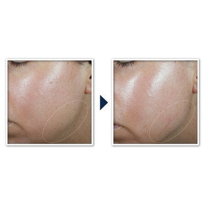 RoC Derm Correxion Contour Cream for Face and Neck 1.7oz - New by This is Beauty US