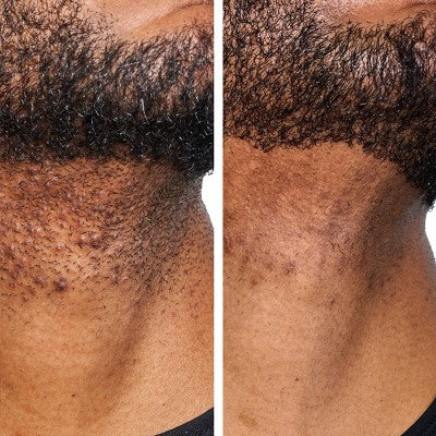 Urban Skin Rx Men&
