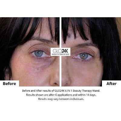 GLO24K 6-in-1 Beauty Therapy Wand for Face Eyes and Neck - New