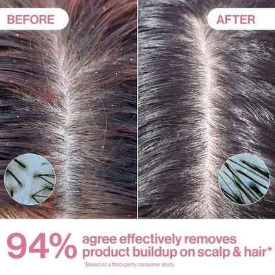 Rizos Curls Apple Cider Vinegar Scalp & Hair Rinse 10 fl oz - Imperfect Container