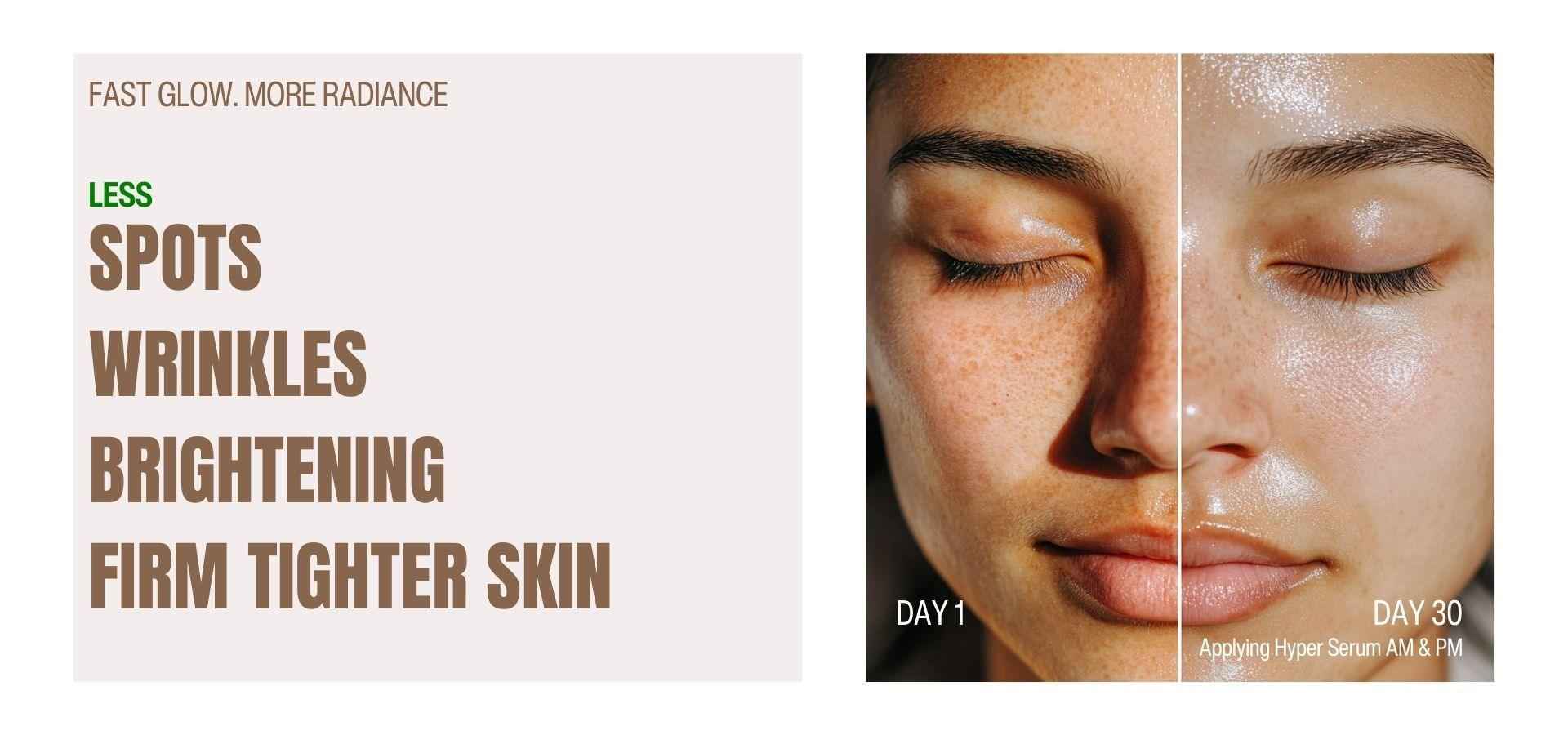 Second Chance Hyper Serum - PM