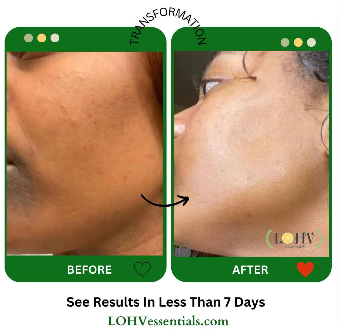 PREMIUM 100% VEGAN GLOW UP Toner Serum With Hyaluronic Acid + Niacinamide + Camellia Leaf + Vitamin E + Rose Water by LOHV ESSENTIALS