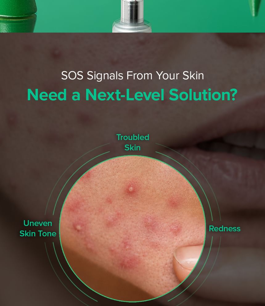 Mary & May Spicule Azelaic PDRN Spot Cream DestGlow