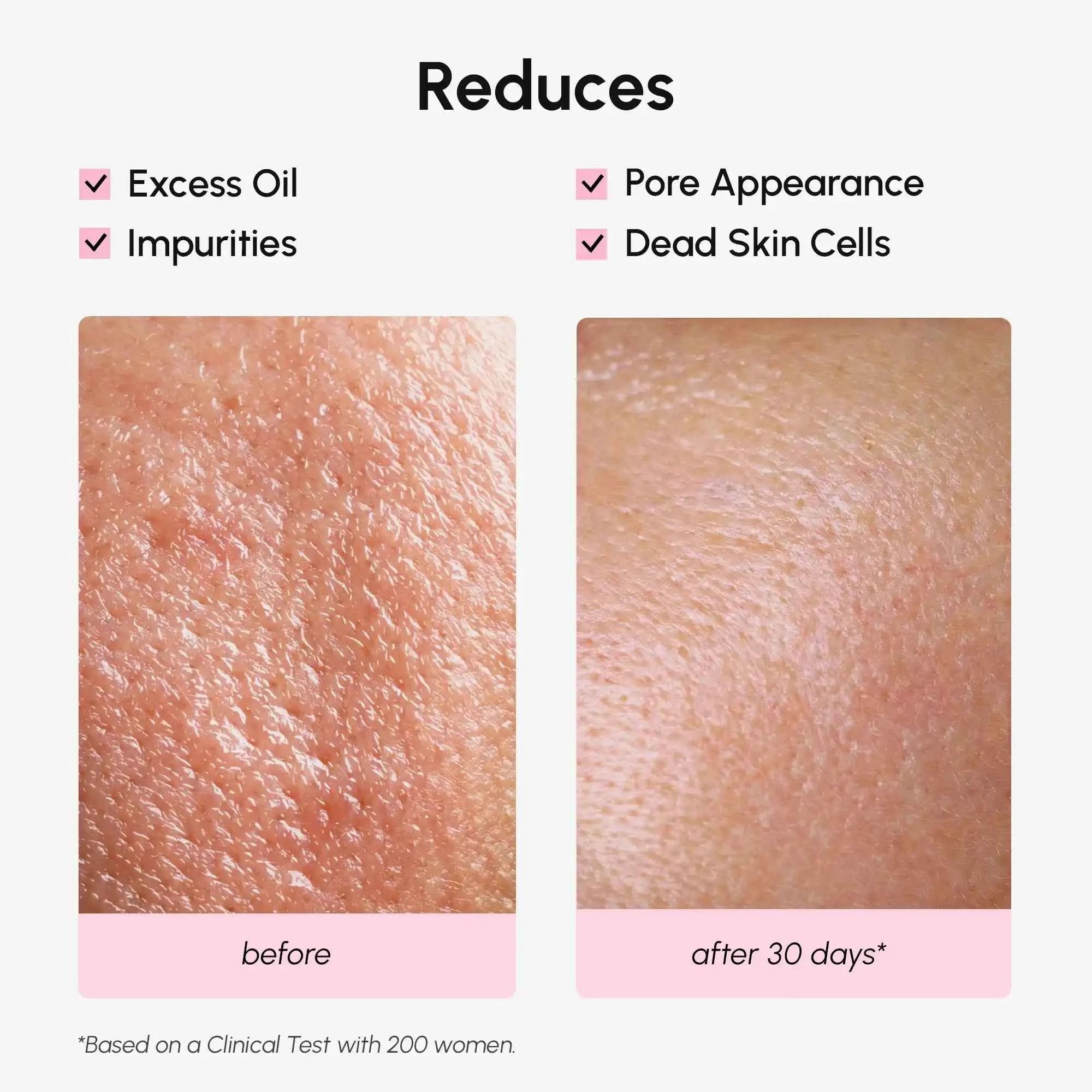 Hydrating Pore Refining Toner