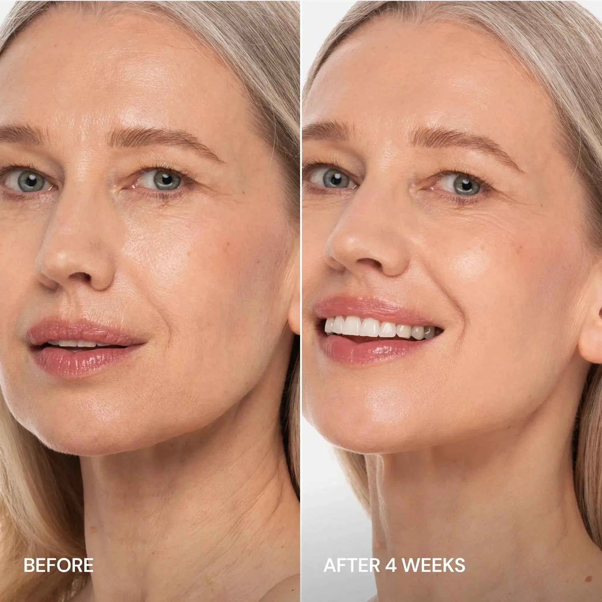 Pro-Retinol Neck Lifting Cream Massager