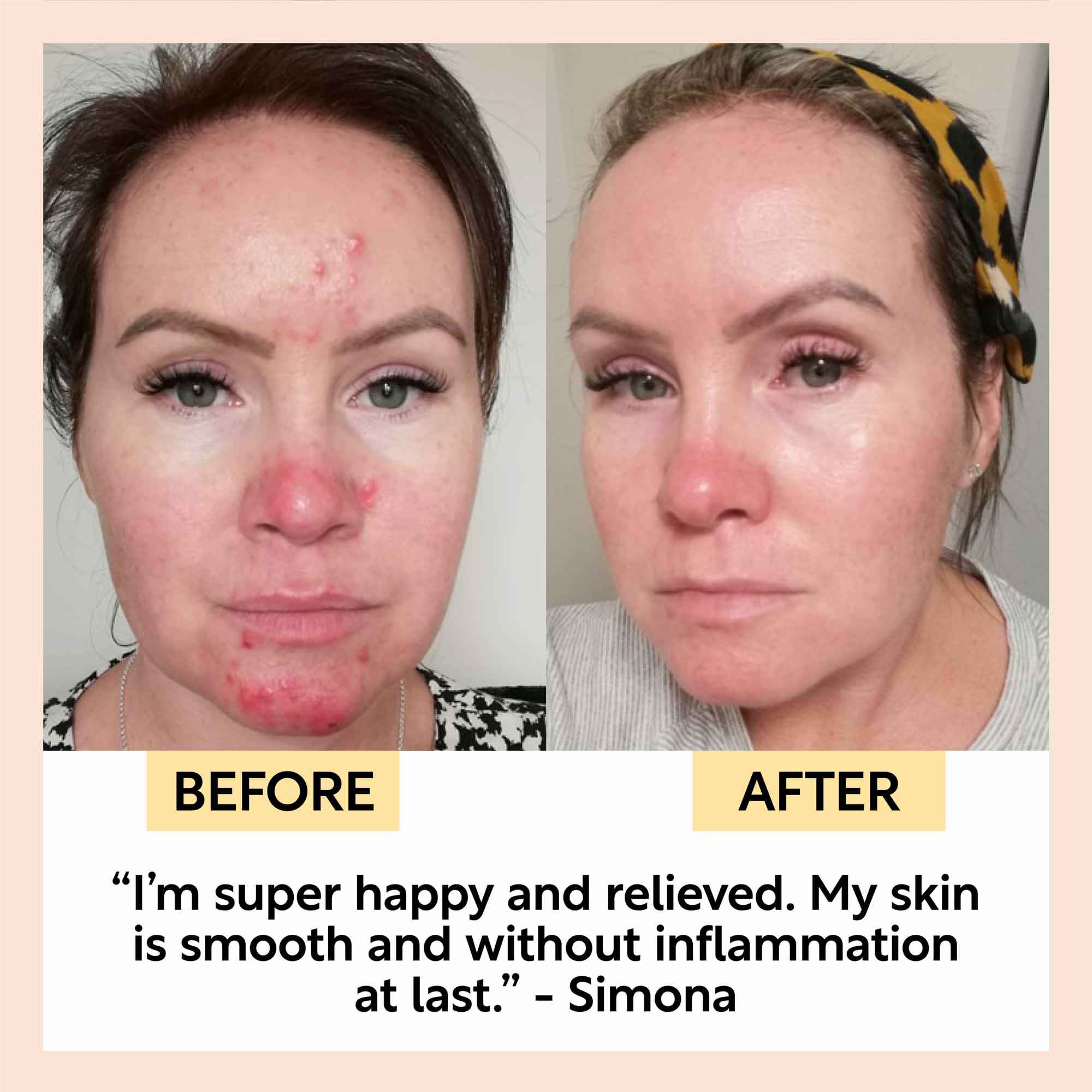 Day + Night Hydration Set by UpCircle