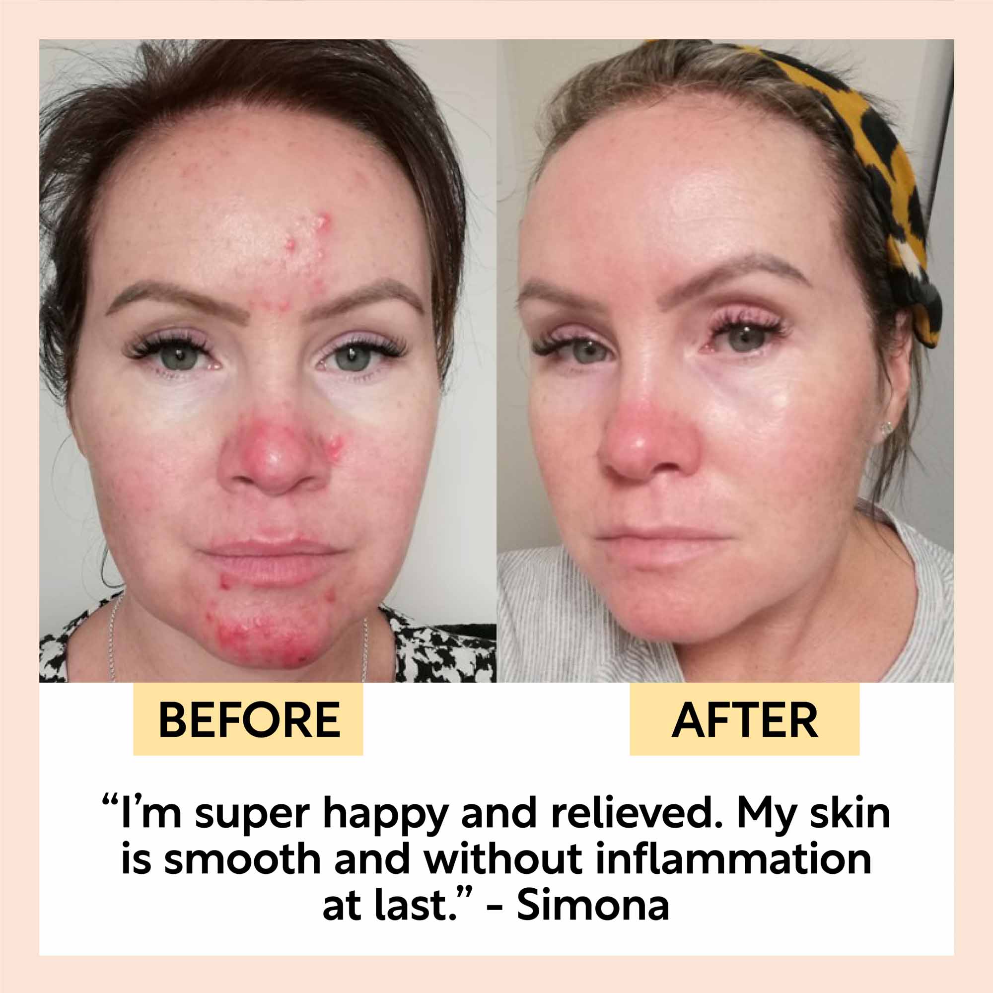 The Sensitive Skin Bundle by UpCircle