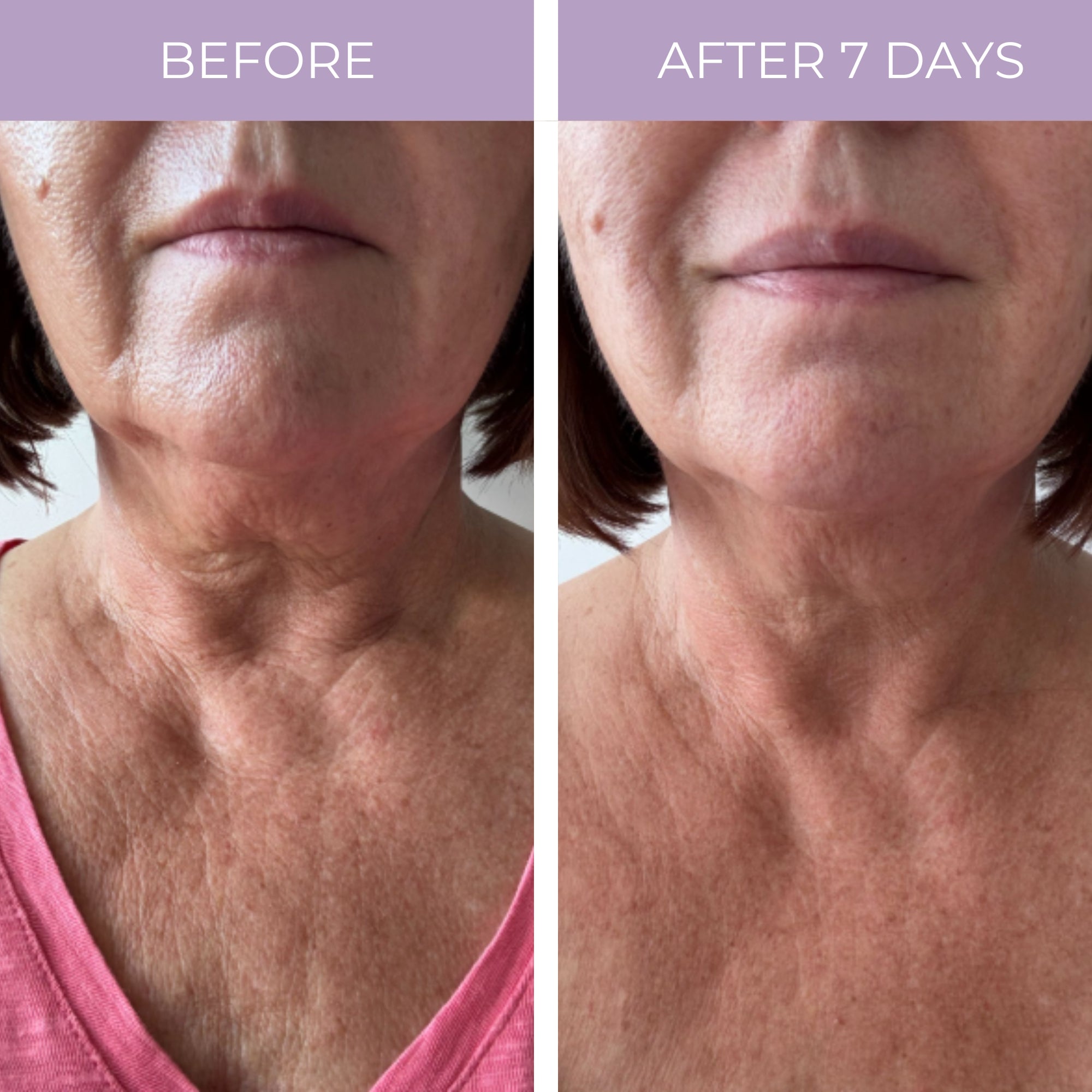 Ageless Throat & Decolletage Anti-Aging Neck Creme DestGlow