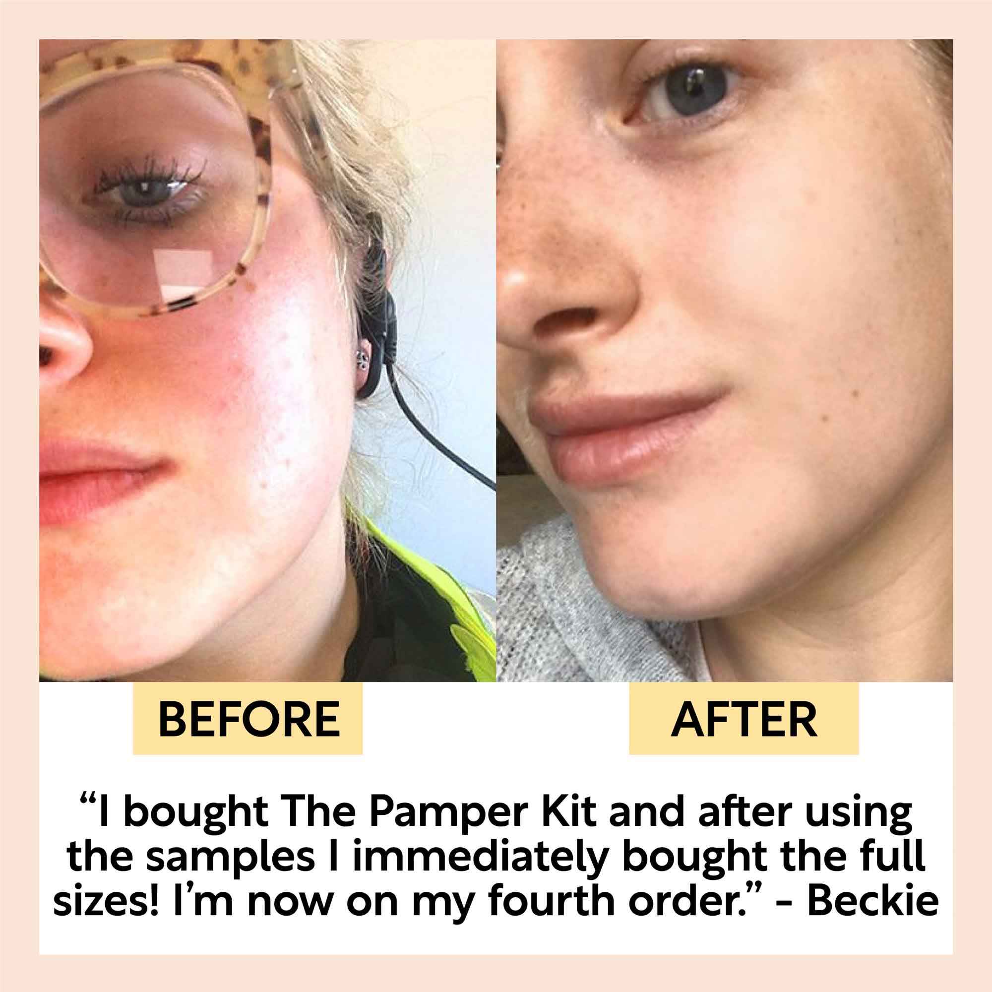 "Pamper + Gift" Skincare Kit