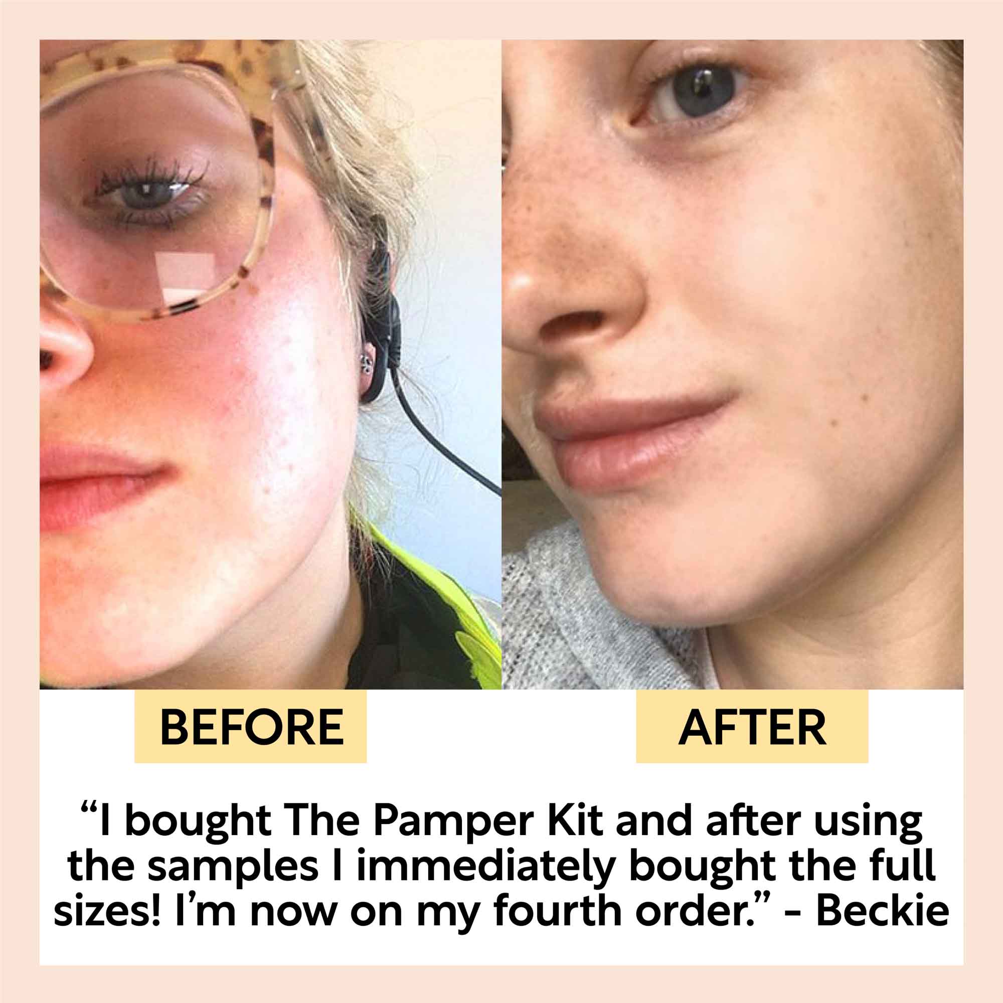 The Pamper Kit by UpCircle