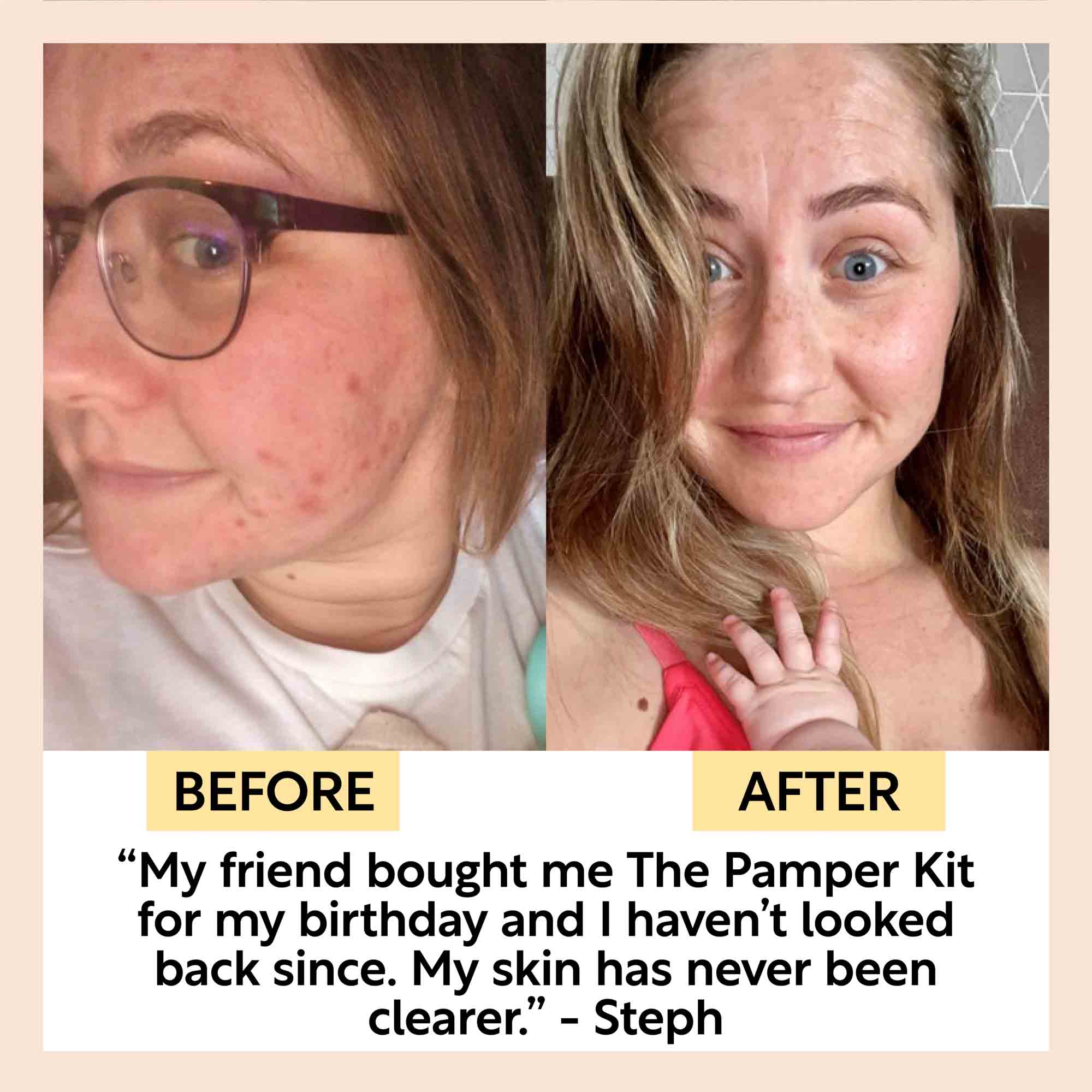 The Pamper Kit by UpCircle