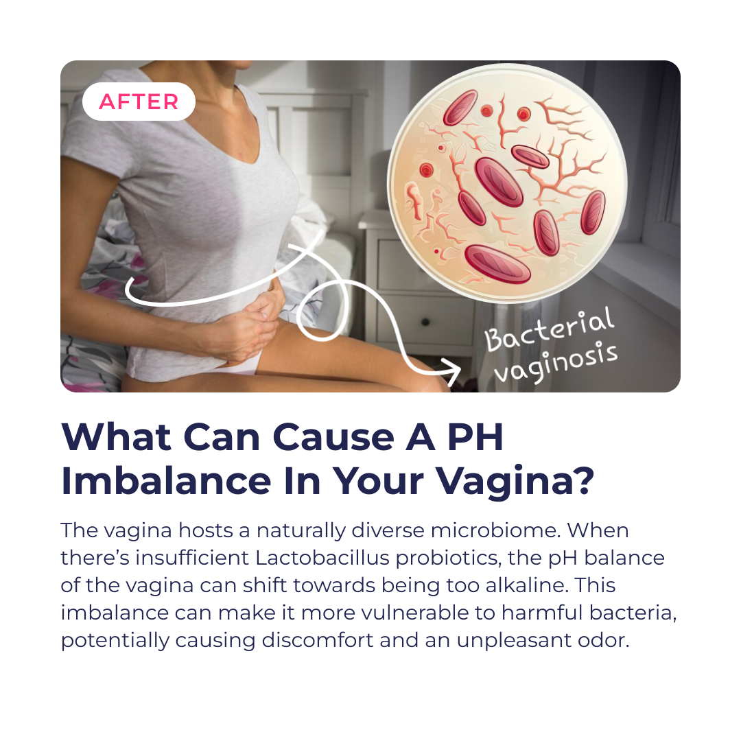Feminine Flora for During & After Menopause by RevitMe by RevitMe - Supplements Store