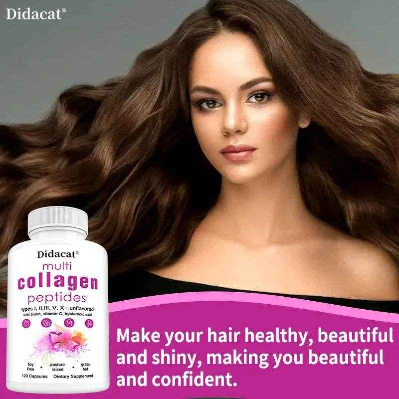 Multi-Collagen Peptides Supplement - Skin, Hair, Nails, Bone and Joint Health, Immunity, Free Radical Balance, Non-GMO