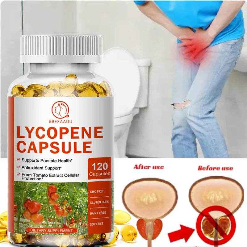 BEWORTHS Lycopene Capsules Support Prostate and Bladder Health, Alleviate Urinary Tract Pain, Male Reproductive Health Support