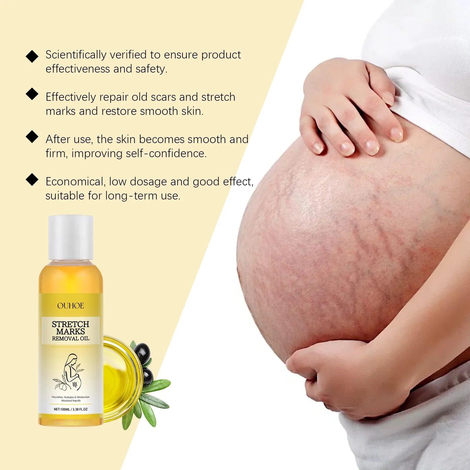 Stretch Mark Lightening Essential Oil Skin Care Cream for Pregnant Women Moisturizing Lifting Firming Skin Slimming Oil 100ml by Roksy