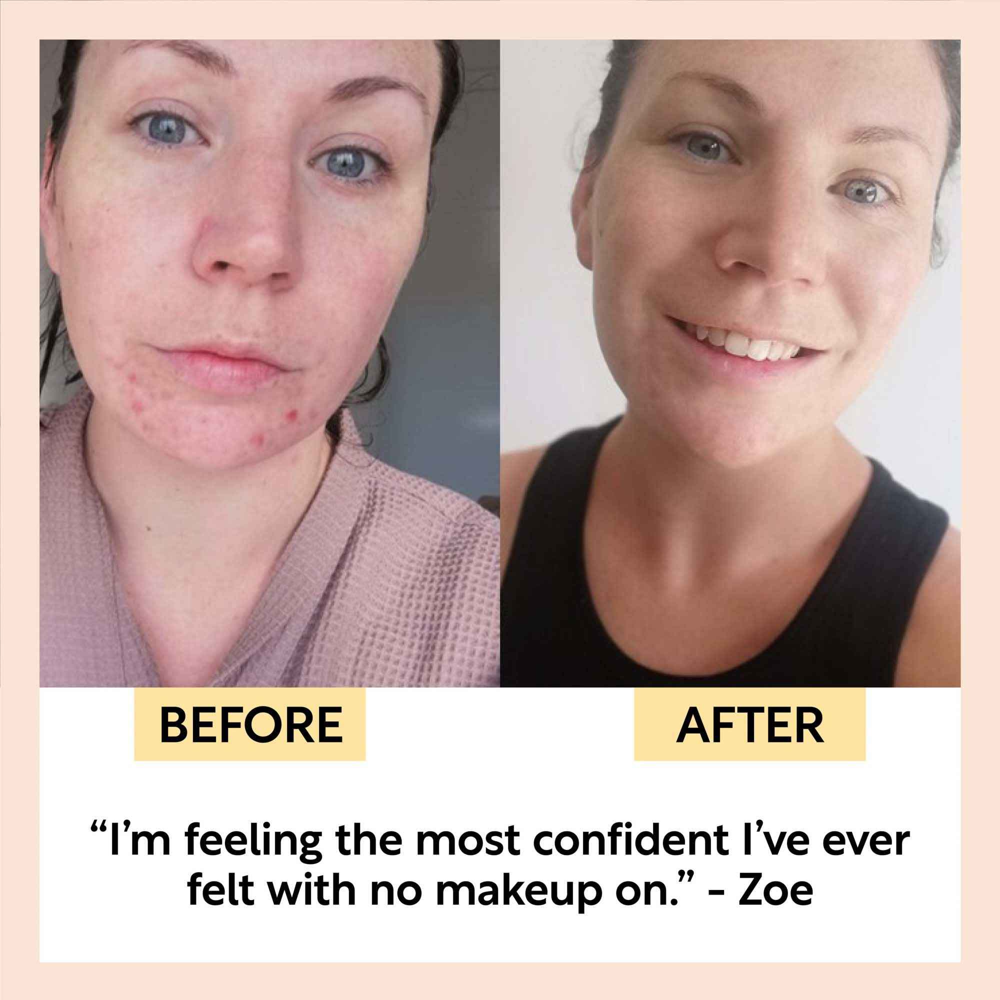 Travel-Size Skincare Bundle