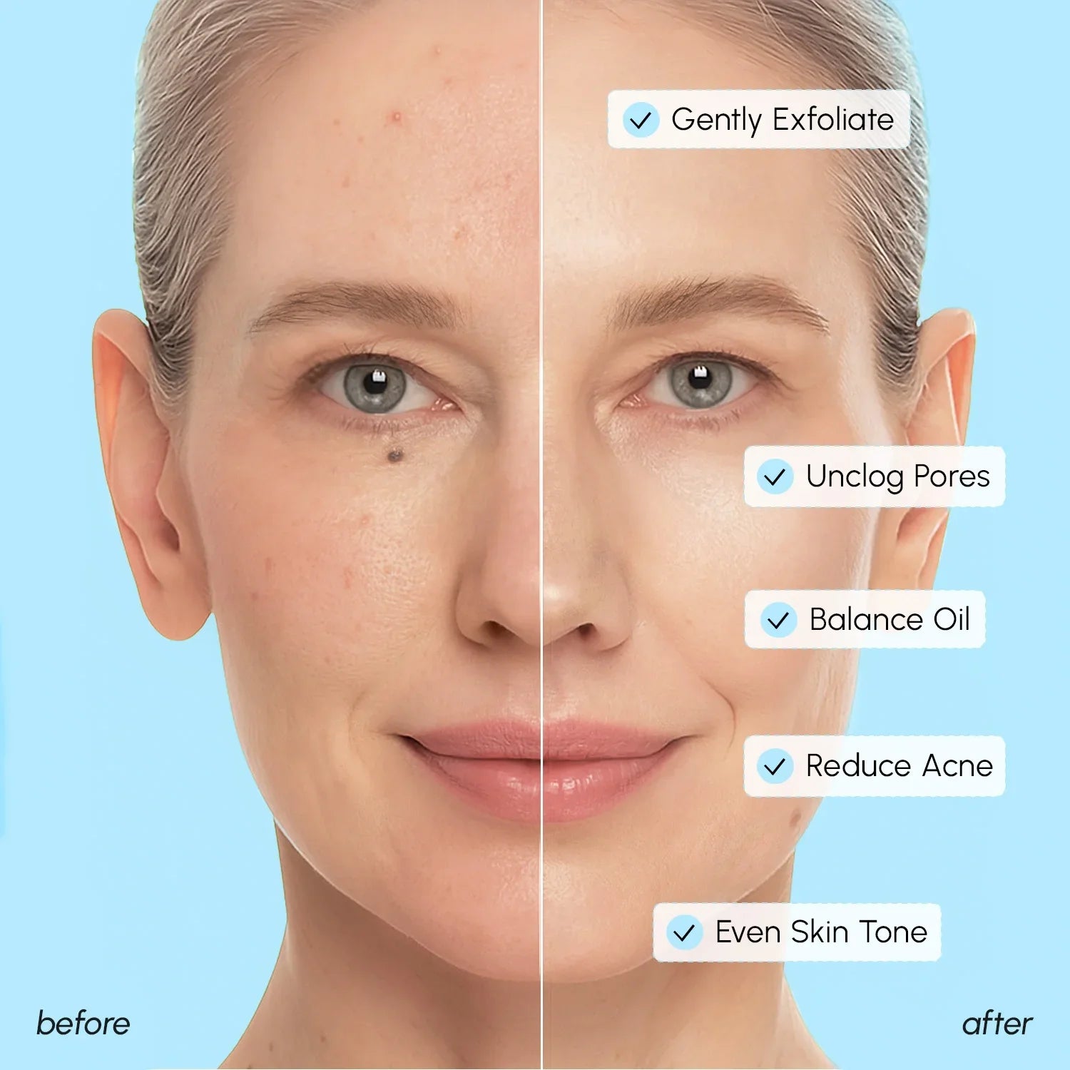 Glycolic & Salicylic Acid Peel Pads DestGlow
