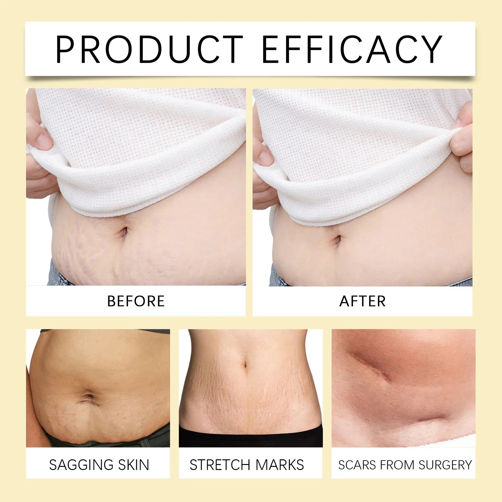 Stretch Mark Lightening Essential Oil Skin Care Cream for Pregnant Women Moisturizing Lifting Firming Skin Slimming Oil 100ml by Roksy