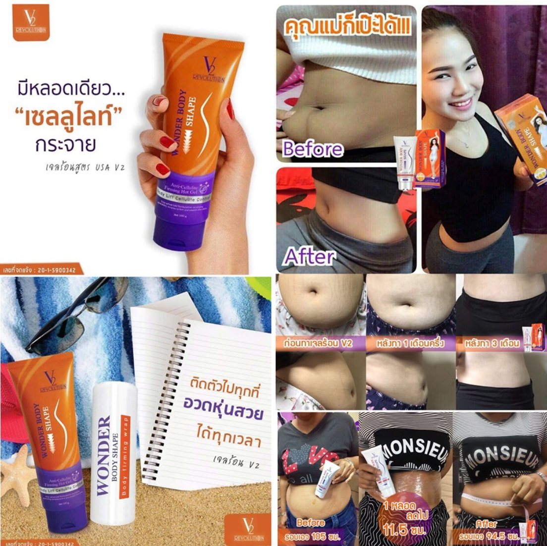 V2 Revolution Stretch Mark & Cellulite Solution