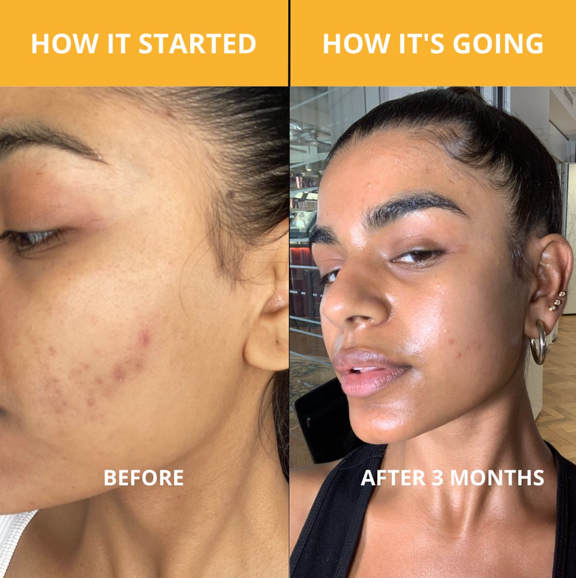 Glow Skincare Bundle DestGlow
