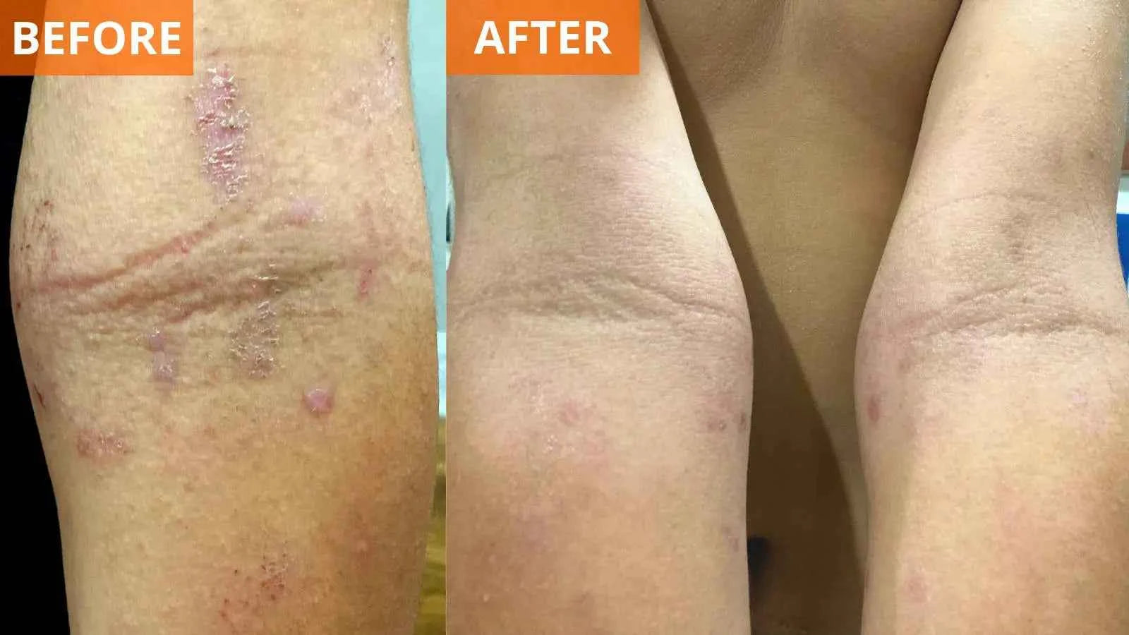 Moisturizing Body Lotion