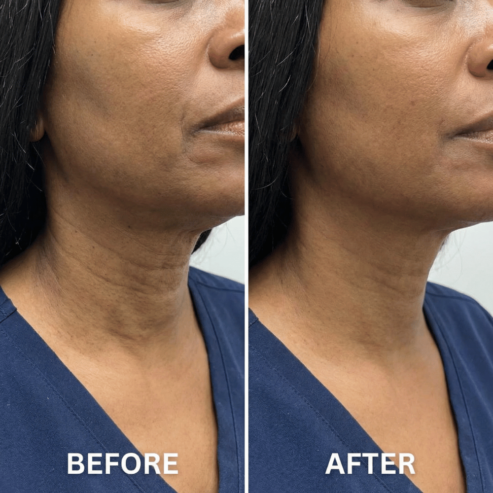 Anti-Cellulite Massage Oil DestGlow