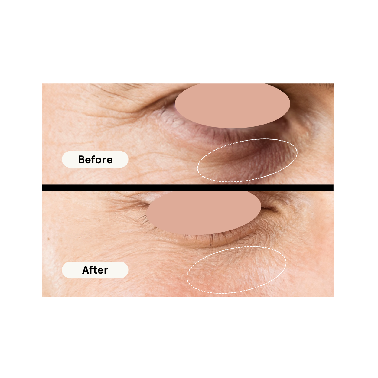 Smooth Criminal - Age Defying Eye Cream DestGlow