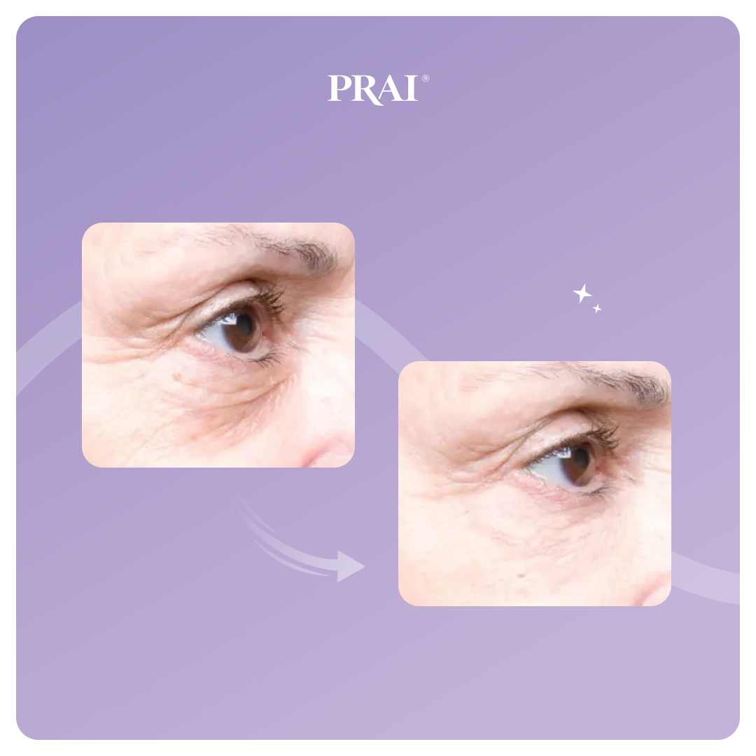 Ageless Eye Tight Uplift Serum DestGlow