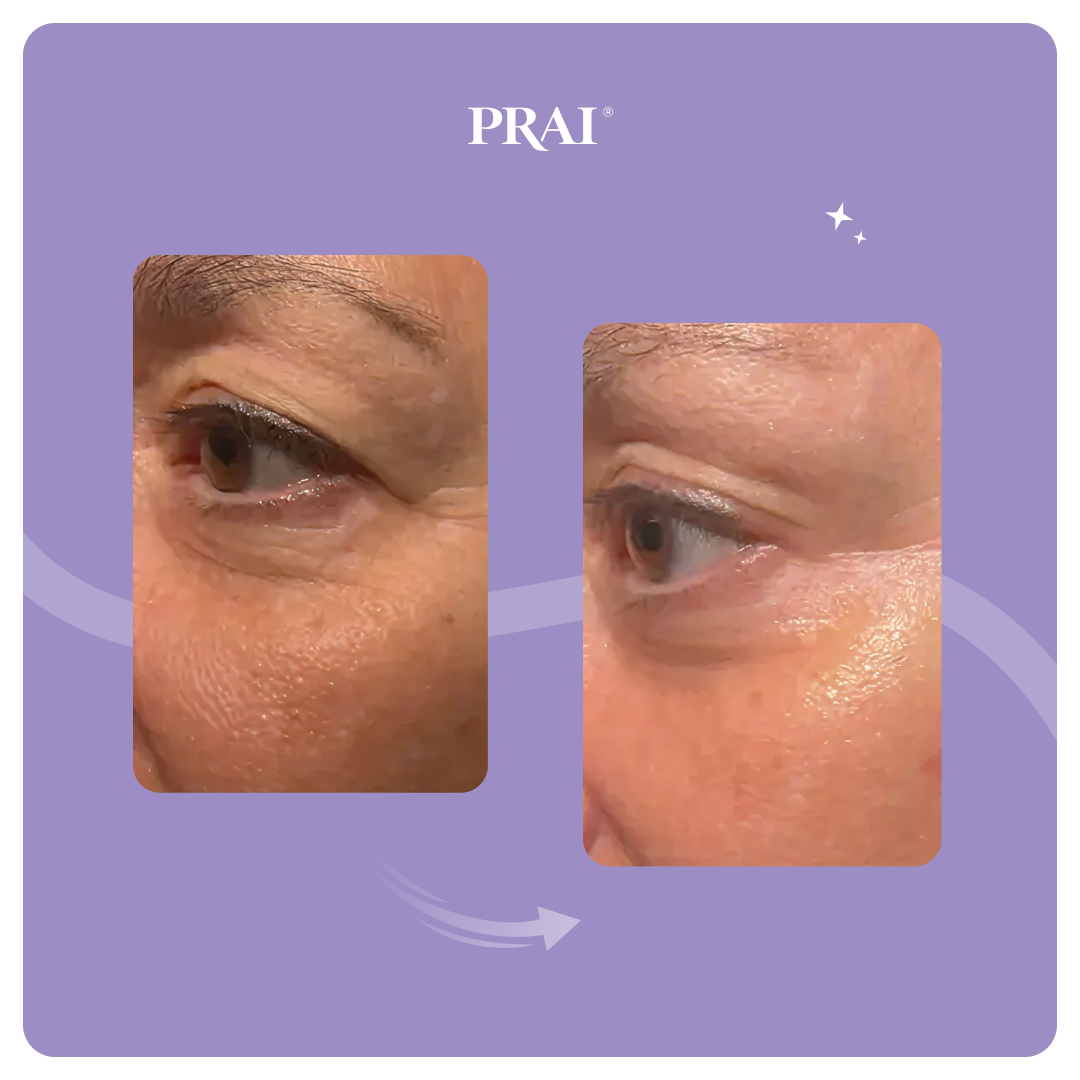 Ageless Eye Tight Uplift Serum DestGlow