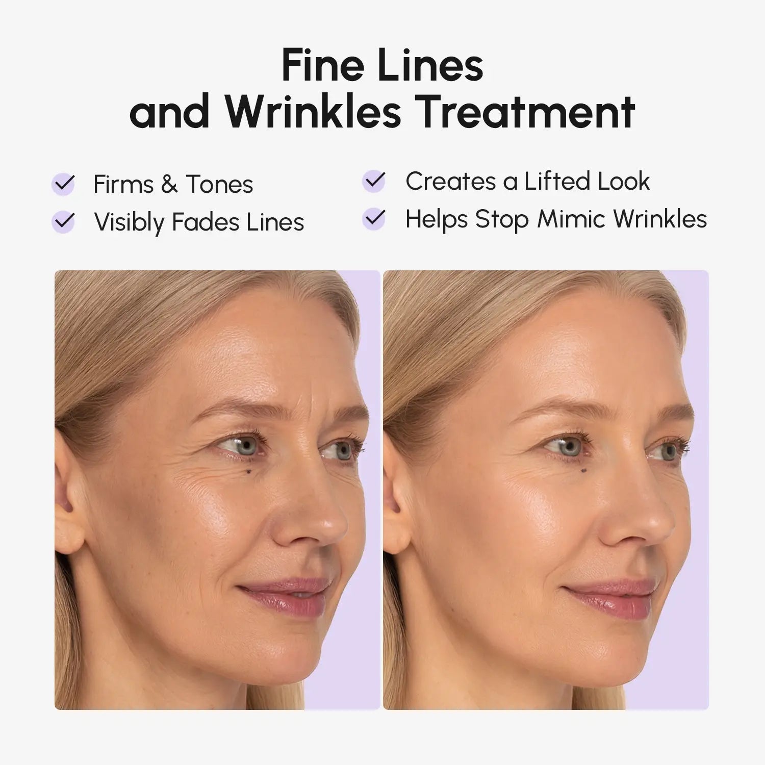 Anti-wrinkle Tape Patches by Maree