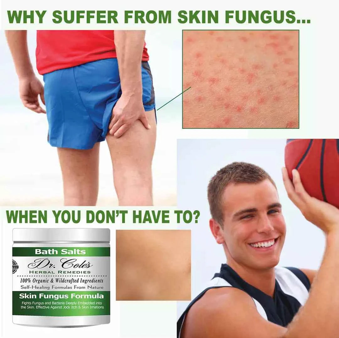 11 - Dr. Cole’s Organic Anti-fungal Skin Soaking Salts by COLEHERBALS LLC