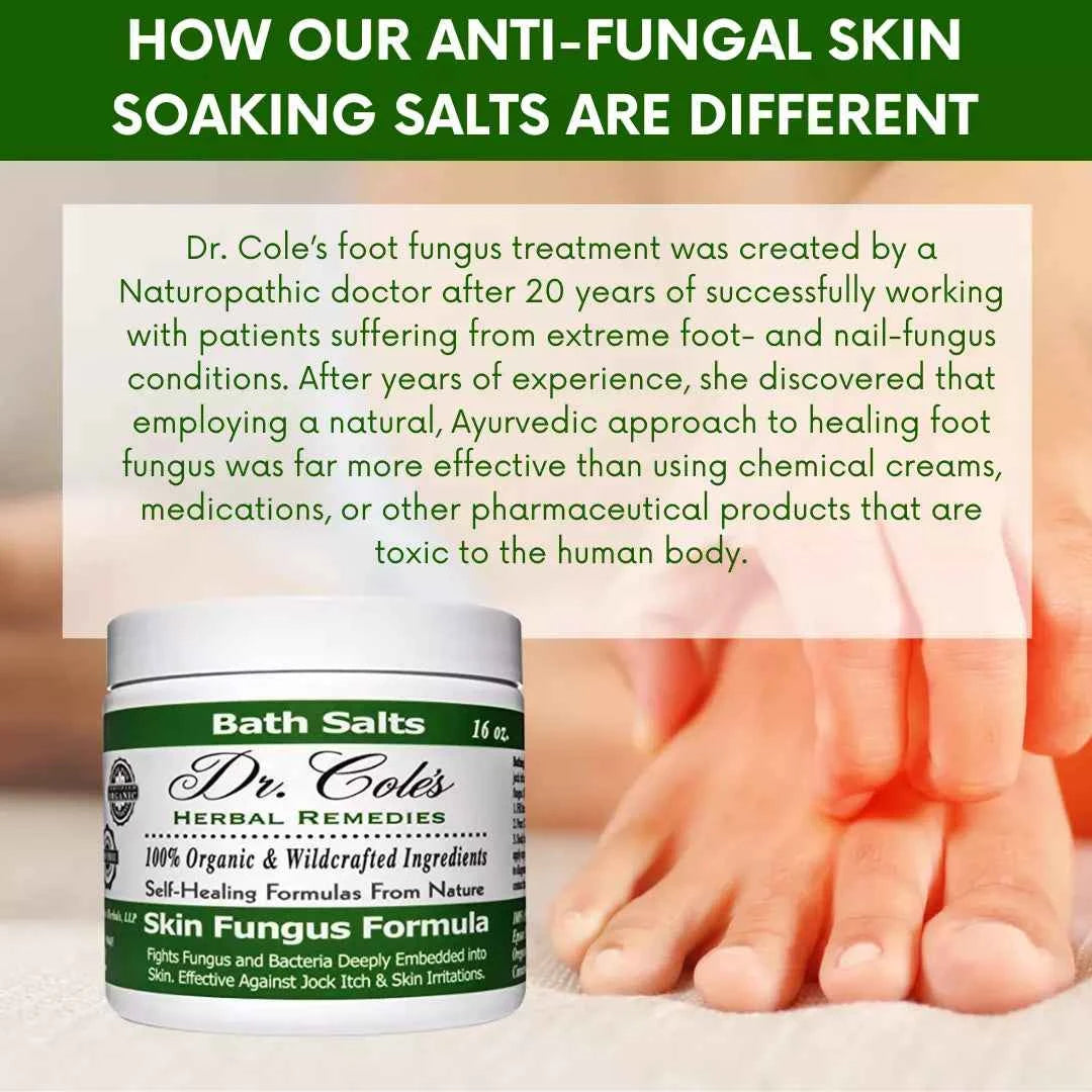 11 - Dr. Cole’s Organic Anti-fungal Skin Soaking Salts by COLEHERBALS LLC