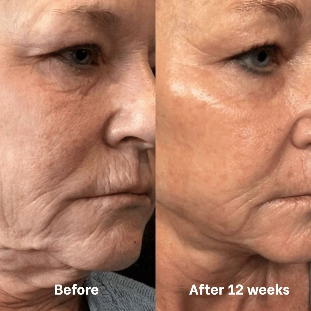 Collagen & Niacinamide wrapping mask by Skynflow