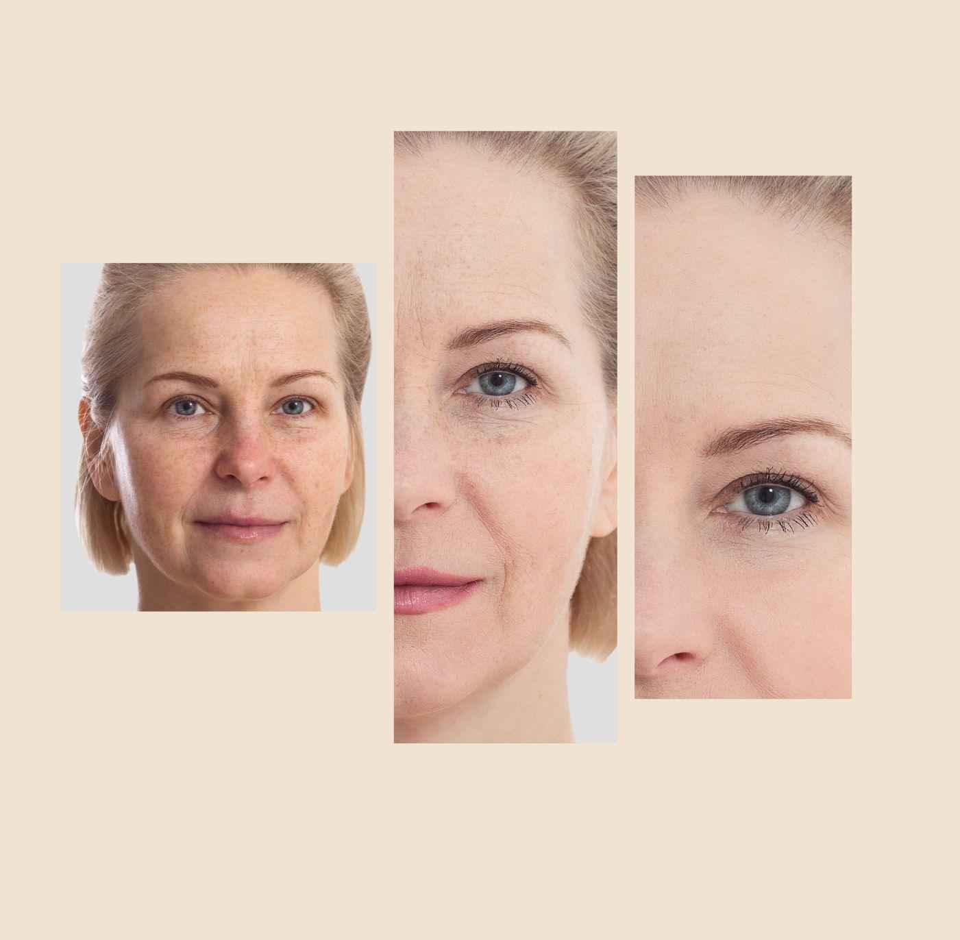 The Eraser Spot Cream | Dark Spot Corrector