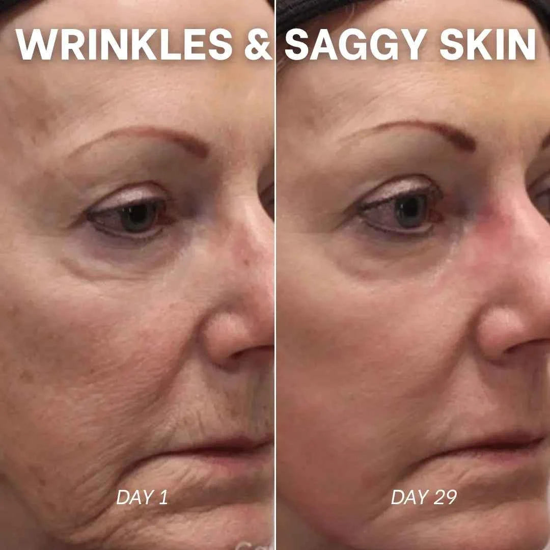 PDRN Collagen Peptide Hydrogel Mask