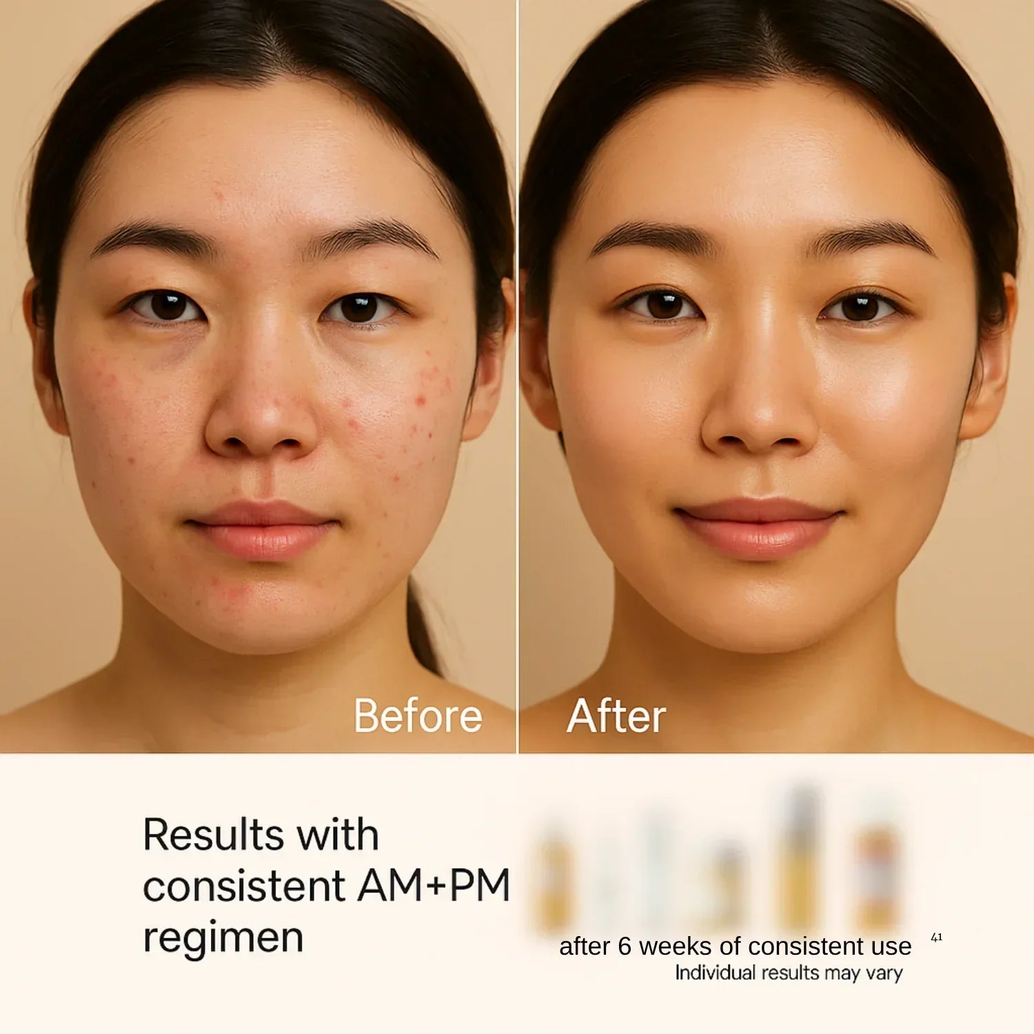 Full-Size Korean Skincare Set for Dark Spots, Fine Lines & Glass Skin