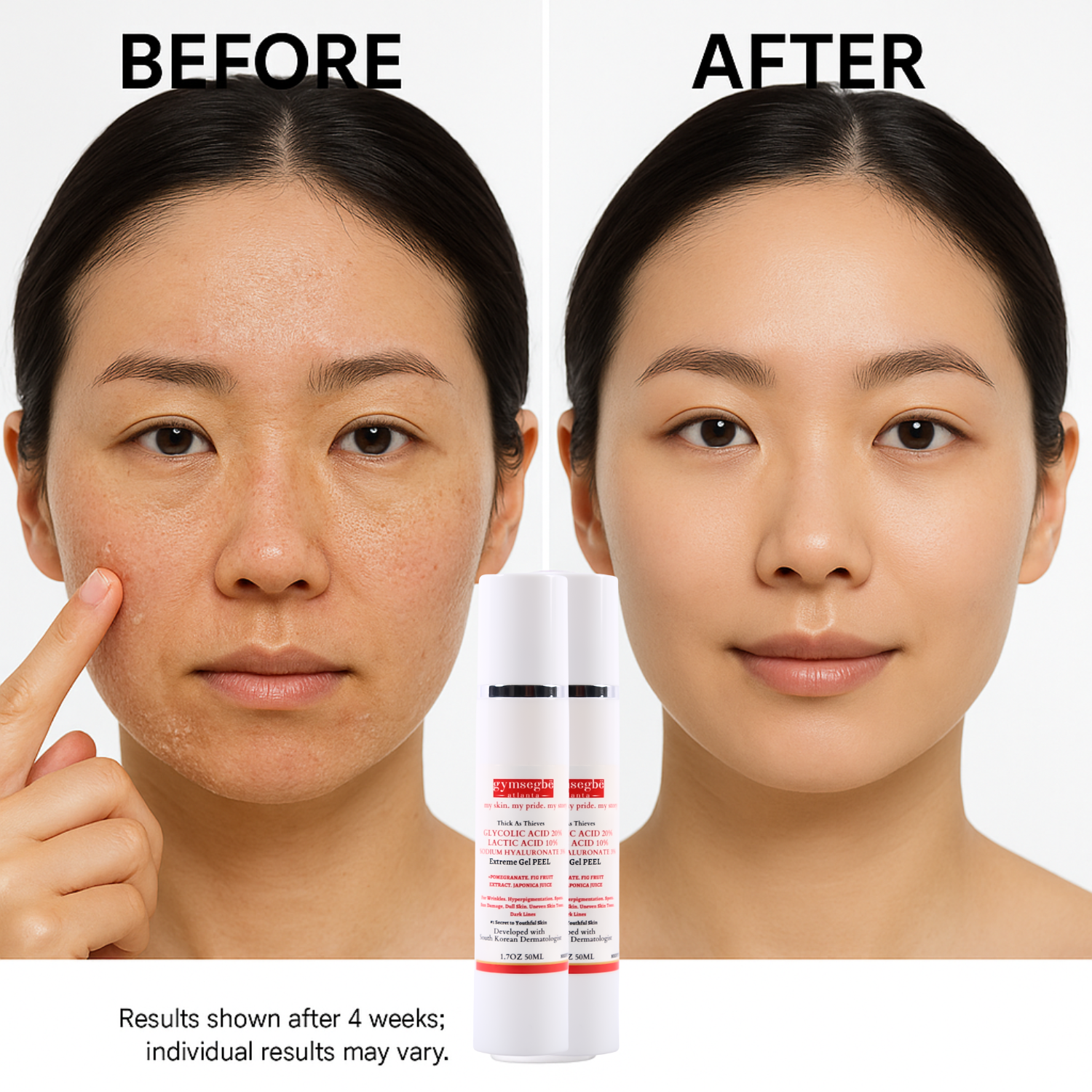 Thick As Thieves Pure Glycolic Acid Lactic Acid Extreme Gel Peel - 50ml by gymsegbë