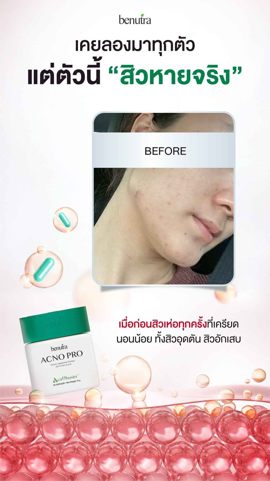 BENUTRA TETRA SOD with Astaxanthin CoQ10 Antioxidant Power for Skin Health