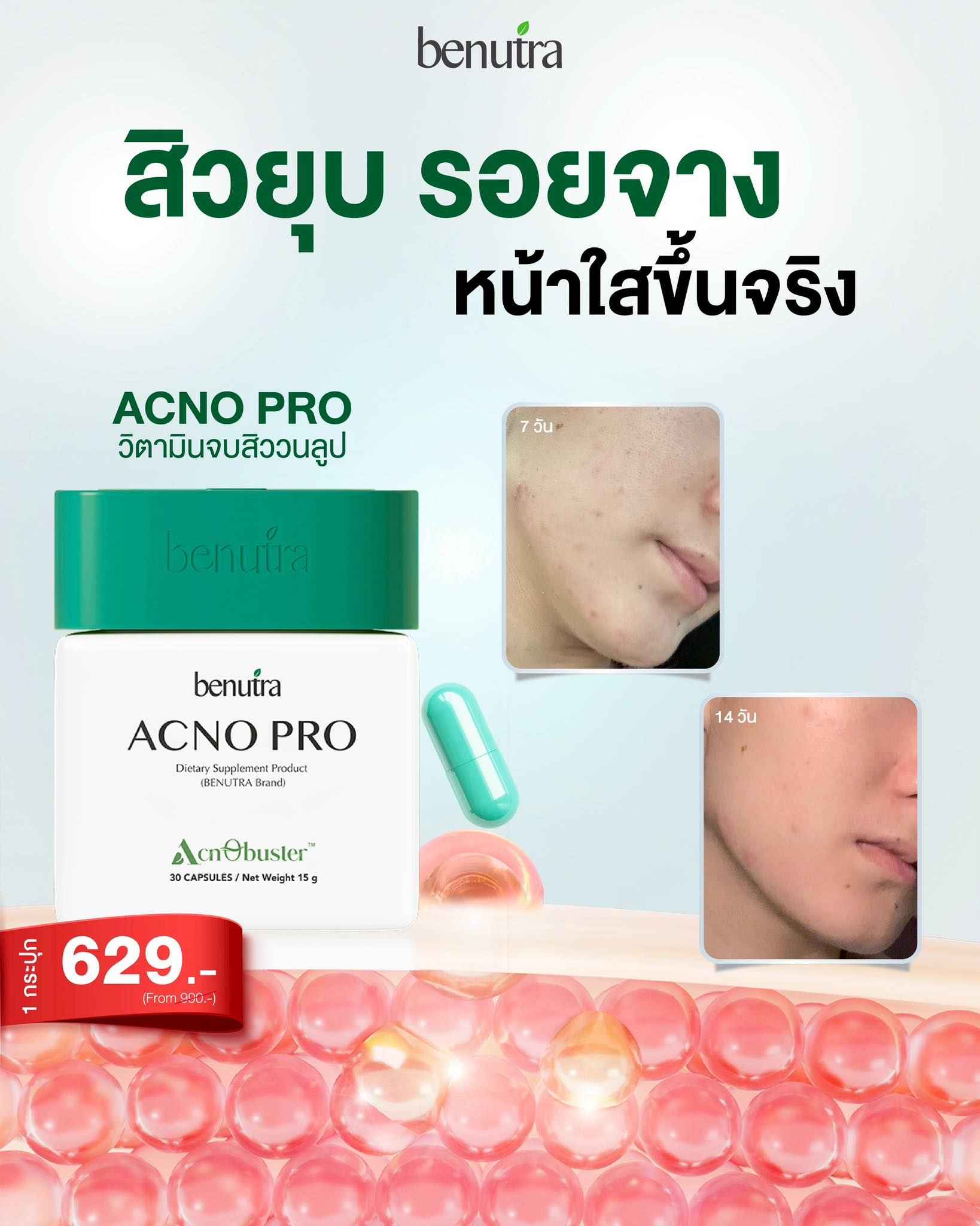 BENUTRA TETRA SOD with Astaxanthin CoQ10 Antioxidant Power for Skin Health