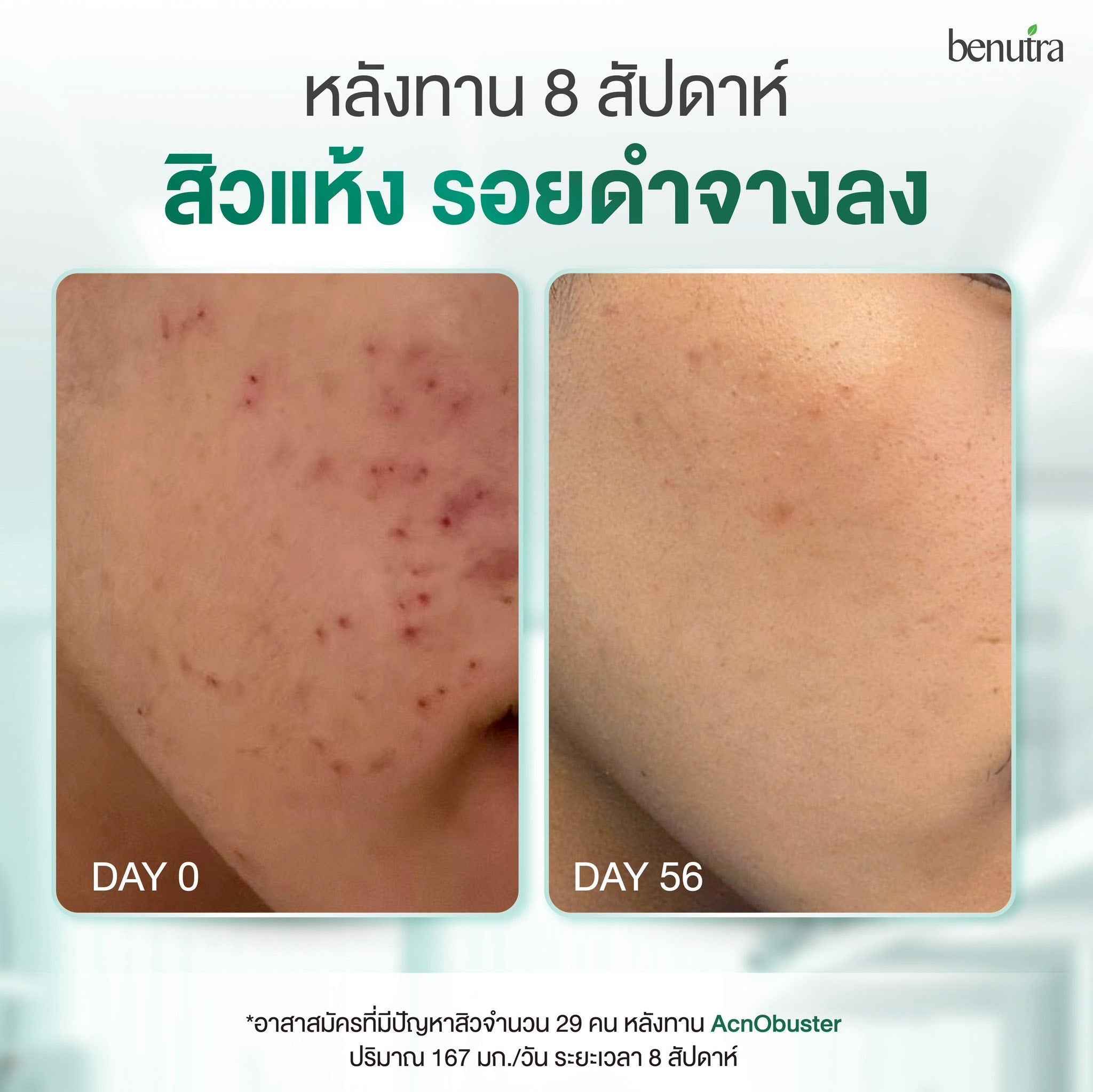 BENUTRA TETRA SOD with Astaxanthin CoQ10 Antioxidant Power for Skin Health