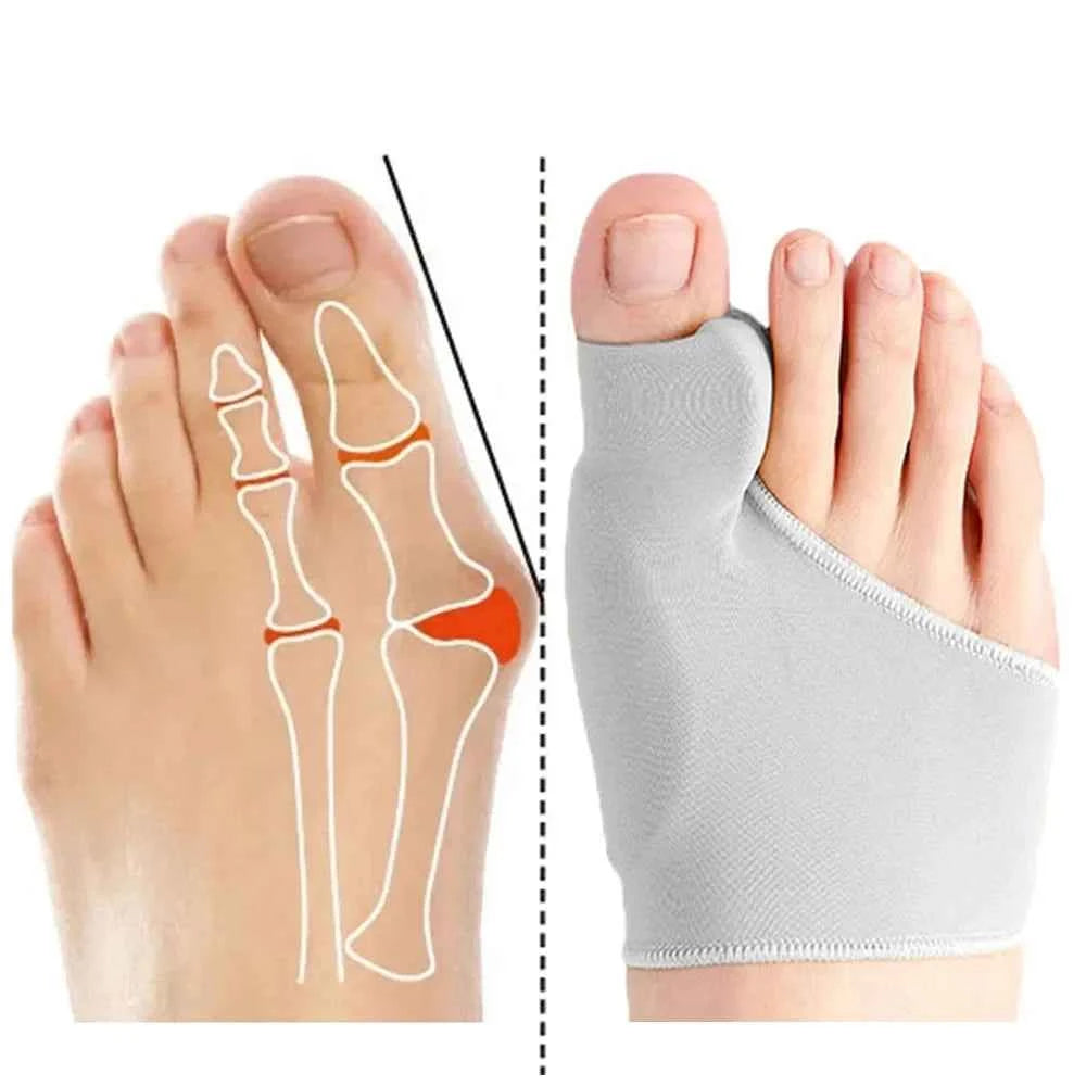 BunEase™ Corrector Socks – Gentle Bunion Pain Relief & Foot Support