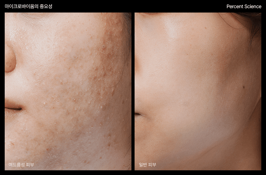 PERCENT SCIENCE Dexynol-16.3 Serum 1.6 Oz. - Acne/Trouble