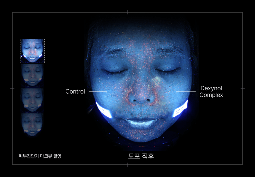 PERCENT SCIENCE Dexynol-16.3 Duo Set. - Acne/Trouble