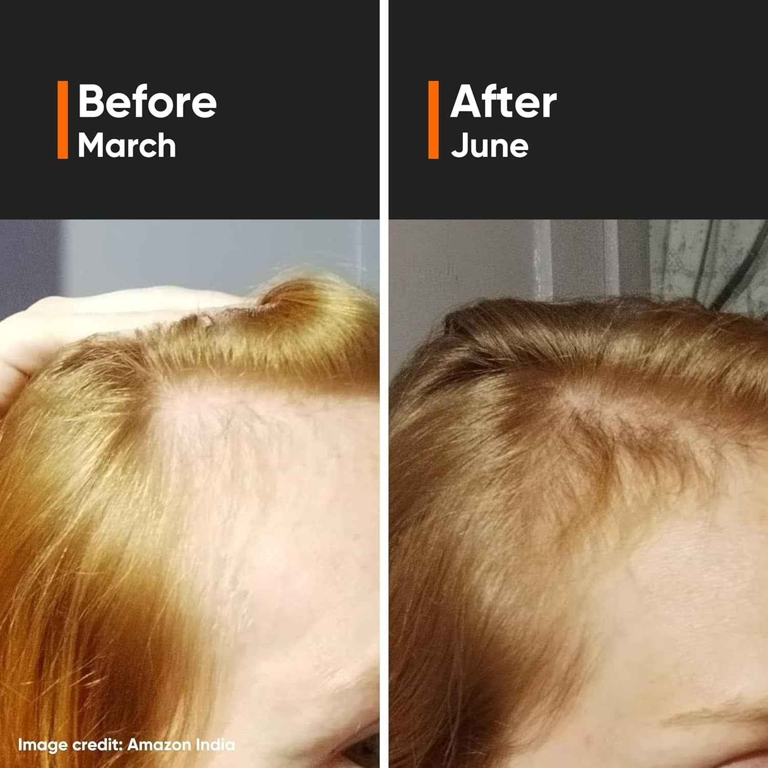 Minimalist Hair Growth Actives 18%