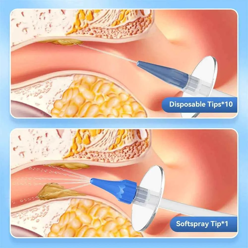 EarClean™ Ear Wax Removal Kit – Safe Irrigation Tips, Home Ear Care & Hygiene