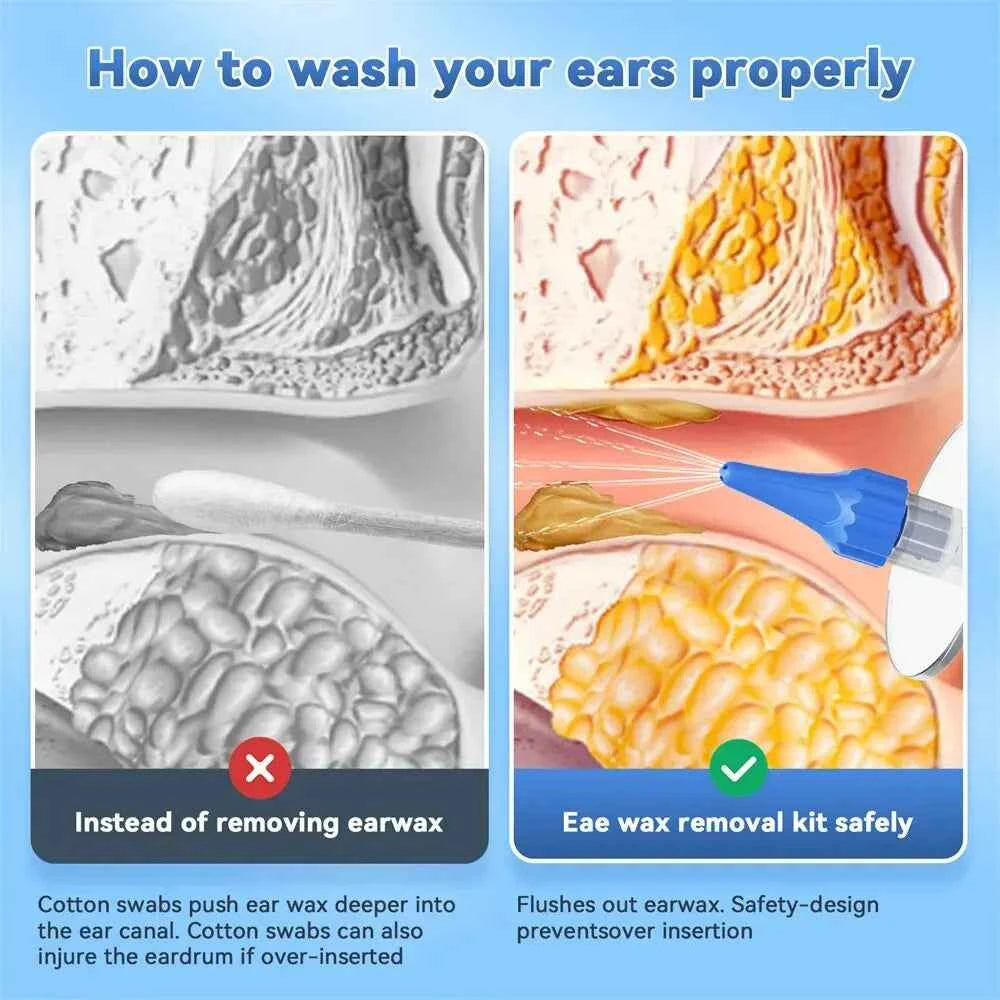 EarClean™ Ear Wax Removal Kit – Safe Irrigation Tips, Home Ear Care & Hygiene