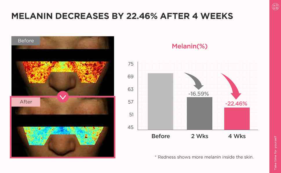 ANUA Peach 70 Niacin Serum
